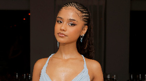 The Grammy-winning singer did not disclose the nature of the injury
