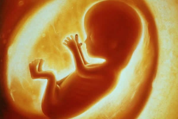 She was provided with medication in an attempt to terminate the pregnancy