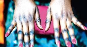Bleached Skin