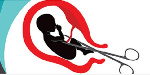 The abortion was allegedly done in the US. File photo
