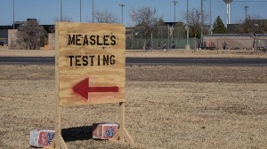 Measles testing site ( stock photo)