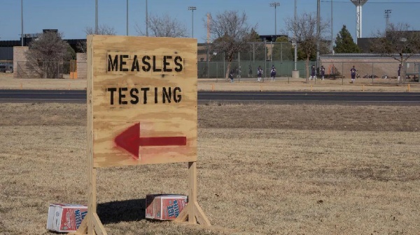 Measles testing site ( stock photo)